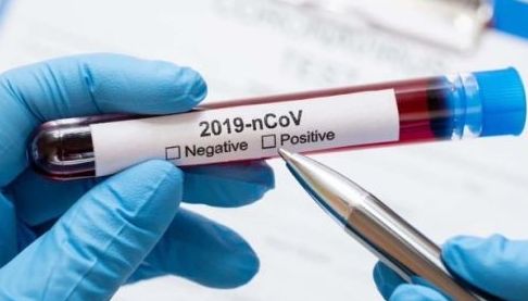 У Харкові зафіксовано перший летальний випадок COVID-19 в епідсезоні 2025-2026