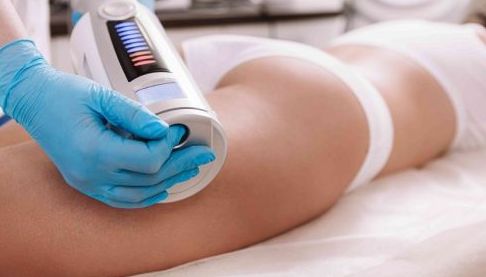 Ендосфера: оптимальна частота процедур і тривалість результату